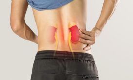 νεφρολιθίαση