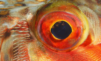 Ρετινοβλάστωμα