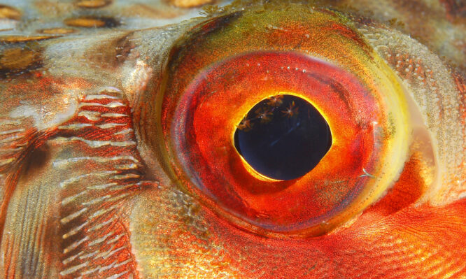 Ρετινοβλάστωμα