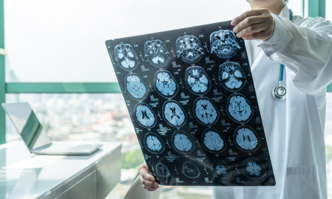 μηνιγγίτιδα