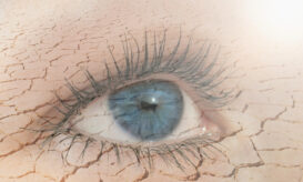 ξηροφθαλμία