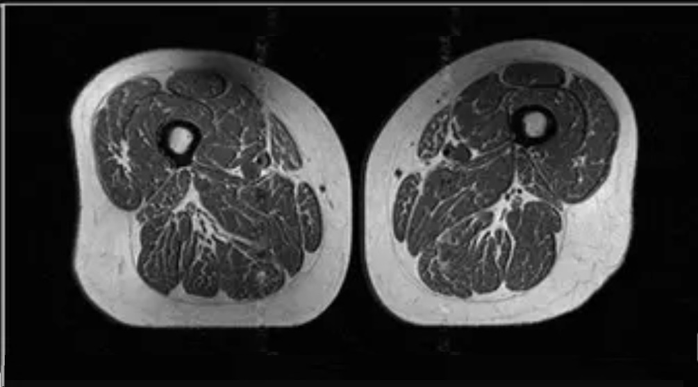 υπερεπεξεργασμένα τρόφιμα
