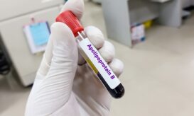 χοληστερόλη