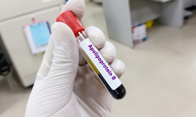 χοληστερόλη