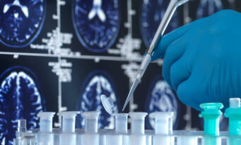 κλινικές μελέτες