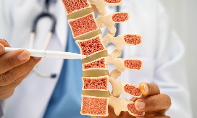 οστεοπόρωση