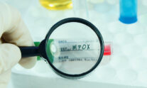 mpox