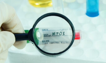 mpox