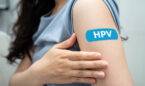 HPV