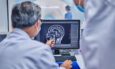 Αλτσχάιμερ, PET SCAN