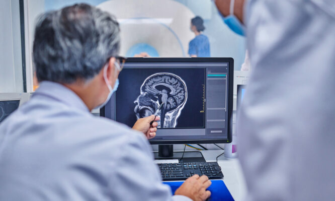 Αλτσχάιμερ, PET SCAN
